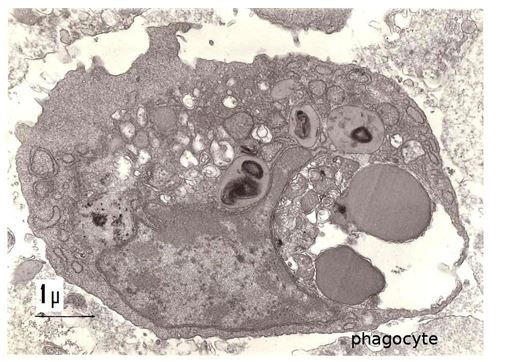 Figure 3: True Phagocyte. Observe the Phagosome greatly opened.