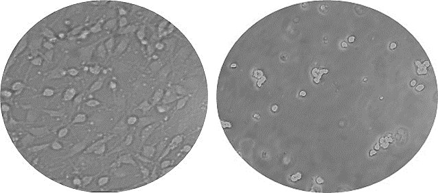 Figure 1: Cytotoxicity effect of MCF-7 cells treated with Phytolacca decandra.