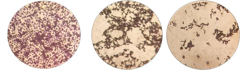 Figure 2: Anti-proliferative effect of MCF-7 cells treated with Phytolacca decandra 6CH and 200CH.