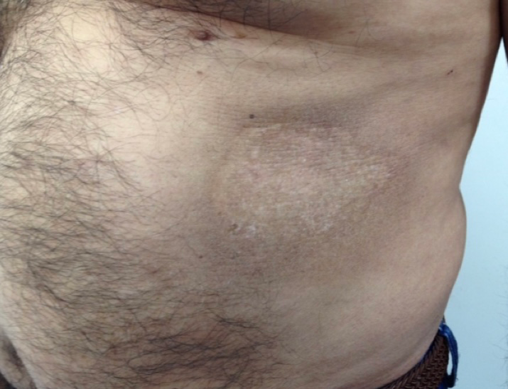 Figure 3: Post therapy clinic