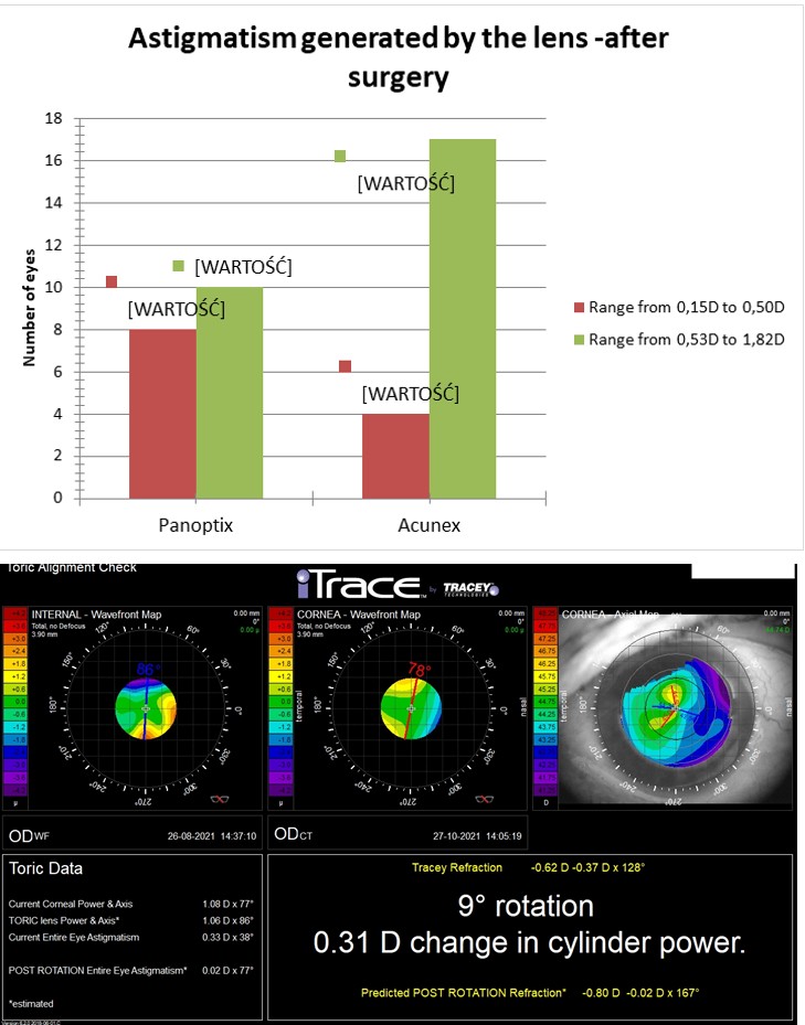 Figure 6: Postoperative TAC result after implantation Acunex VARIOMAX lens. Woman, age 73, diagnosed with cataract. Preoperative corneal astigmatism: RE: 0.25 Dcyl 126°, angle alpha RE: 0.112, angle kappa RE: 0.140, pupil size RE: 3.1 mm. Postoperative result of Toric lens Power & Axis ® = 1.06 Dcyl x 86º suggests an implantation of toric lens.