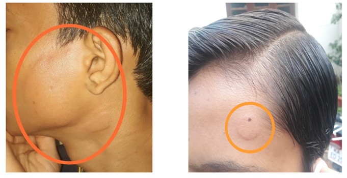 Figure 2: Commonly seen visuals of drug reactions.