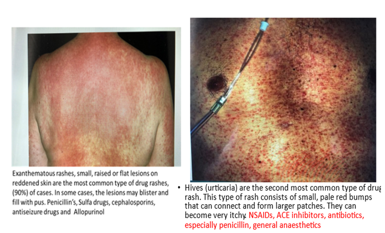 Figure 3: Exanhematous rashes.