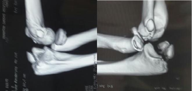 Figure 2: CT Image.