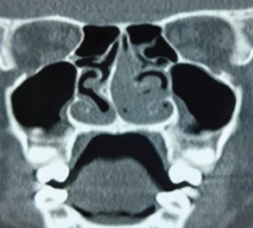 Figure 2: Lower jaw.