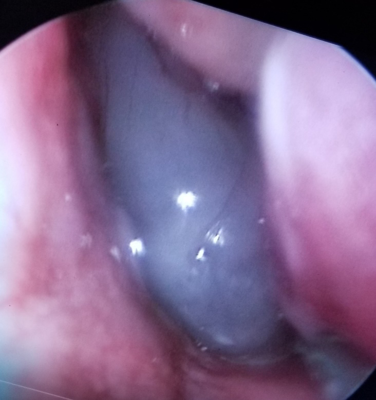 Figure 3: Coronal view.