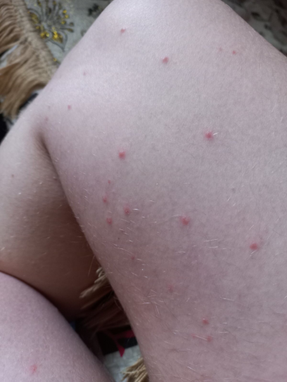 Figure 1: Clinical case 1 before