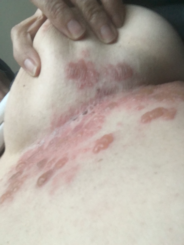 Figure 10: Clinical case 5.