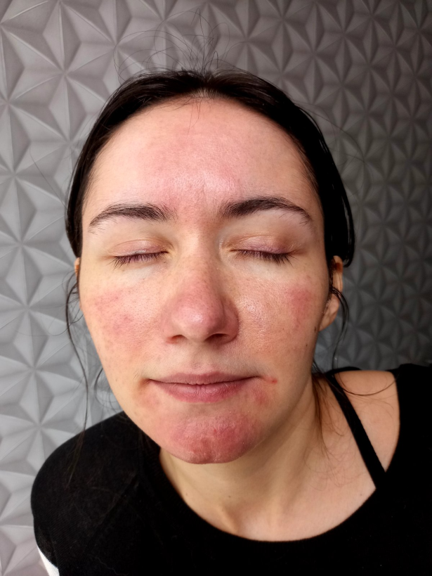 Figure 12: Clinical case 6.