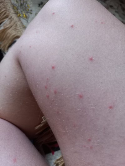 Figure 2: Clinical case 1 before