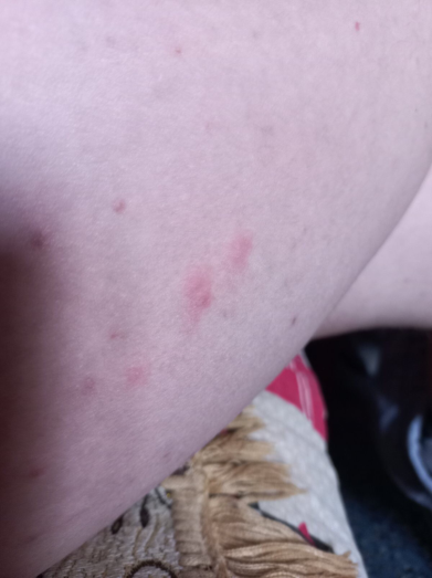 Figure 3: Clinical case 1 after.