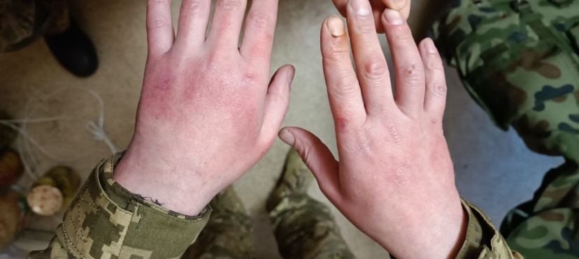 Figure 4: Clinical case 2.
