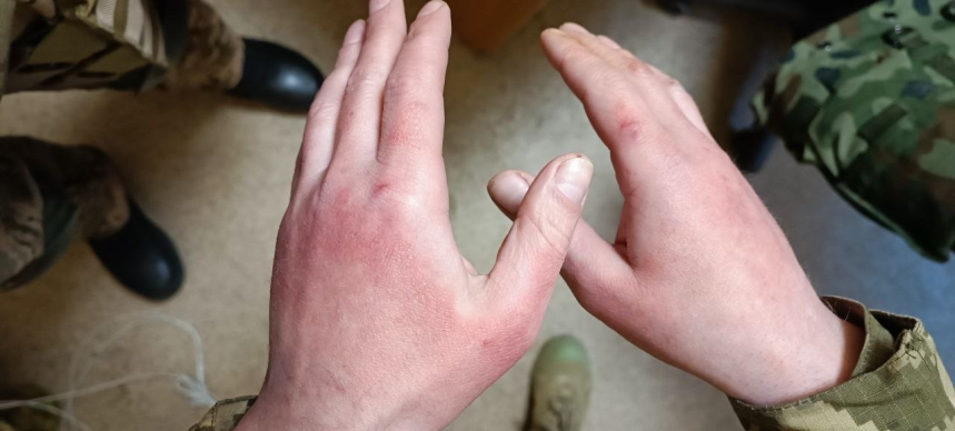 Figure 5: Clinical case 3.