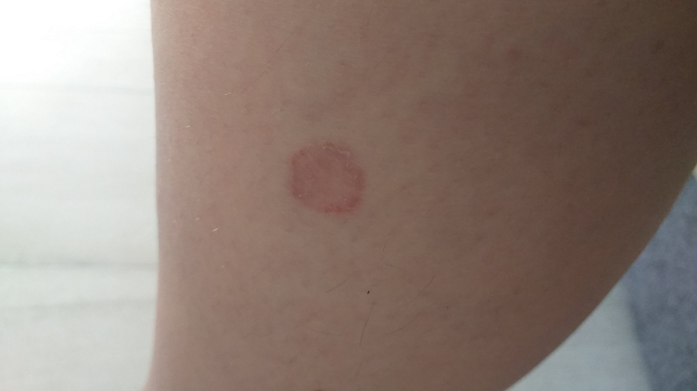 Figure 6: Clinical case 3.
