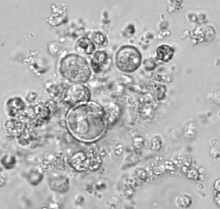 Figure 1: Human colon organoid. Tissues were obtained from The University of Maryland School of Medicine with informed consent and the study was approved by the ethical committee. The isolation of healthy crypts was performed essentially as described by Sato et al [5].