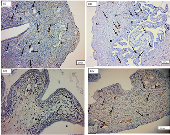 Figure 1: Photomicrographs of cross section in the rat uterus showing many c-kit-positive cells (arrows) in the endometrium (E) in–between endometrial stromal cells, near to blood vessels and around endometrial gland (EG), inner circular(IC), middle stratum vasculare(SV) and outer longitudinal(OL) smooth muscle layers in(GI), (GII),(GIII), (GIV). (C-kit immunohistochemistry counterstained with Hx, (GI, GII, GIV) & (GIII), O.M, X100&200 respectively).