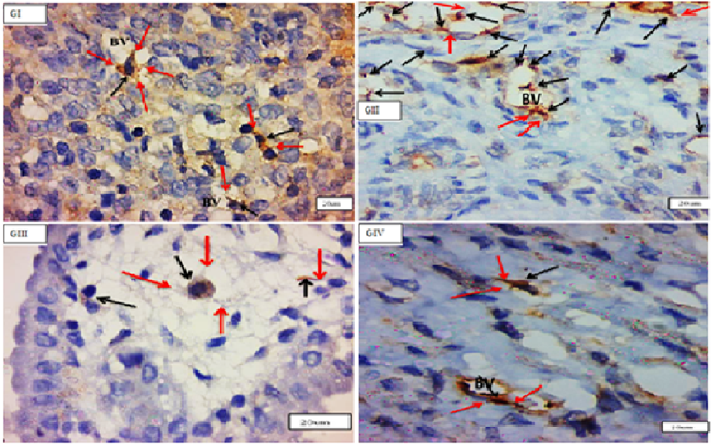 Figure 2: Photomicrographs of cross sections in the rat uterus showing endometrium c-kit-positive cells telocytes(black arrows) with processes (telopodes) (red arrows), blood vessels (BV) in (GI), (GII), (GIII) &(GIV). (C-kit immunohistochemistry counterstained with Hx, O.M, X100).