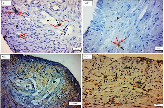 Figure 4: Photomicrographs of cross sections in the rat uterus myometrium (OL) layer showing many c-kit-positive cells telocytes (black arrows) inbetween muscle fibers mainly in (GIII), around blood vessels (BV) IN (GI), (GII), (GIII) & (GIV). (C-kit immunohistochemistry counterstained with Hx, O.M, X400).