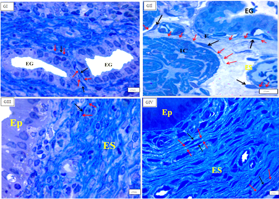 Figure 5: Photomicrographs of semithin sections in the endometrium showing that telocytes (black arrows), telopodes (red arrows) below surface epithelium (EP), in-between endometrial stroma (ES) and around endometrial glands (EG) in (GI), (GII), (GIII) & (GIV) (Semithin, Toluidine blue, O.M, x1000)