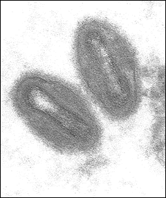Figure 1: Electron micrograph showing monkeypox virus [9].