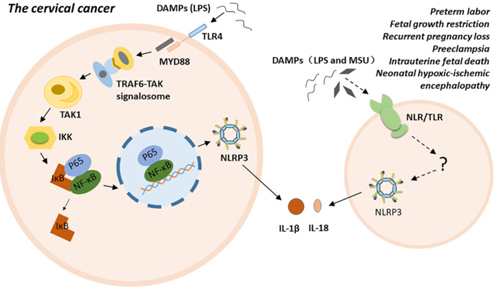 Figure 2: Role of NLRP3 in gynae dis.