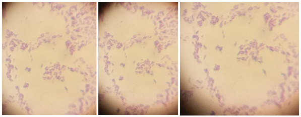 Figure 1: Selected microscopic morphology of gram-negative rods isolated from live fish.