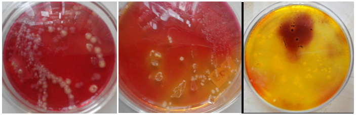Figure 2: Selected colony morphology of gram-negative rods isolated from liv fish on XLD agar.