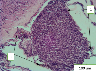 Figure 1: Morphological rearrangements of the pineal gland’s structural components under the condition of 60 days exposure to heavy metal salts and correction with α-tocopherol acetate: 1 - preservation of the anatomical shape of the pineal gland; 2- the connection with the vascular plexus. Hematoxylin-eosin staining.