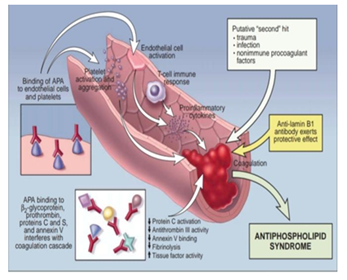 Figure 1: Presence of thromboembolic complications and pregnancy.