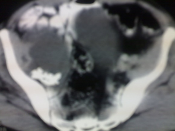 Figure 9