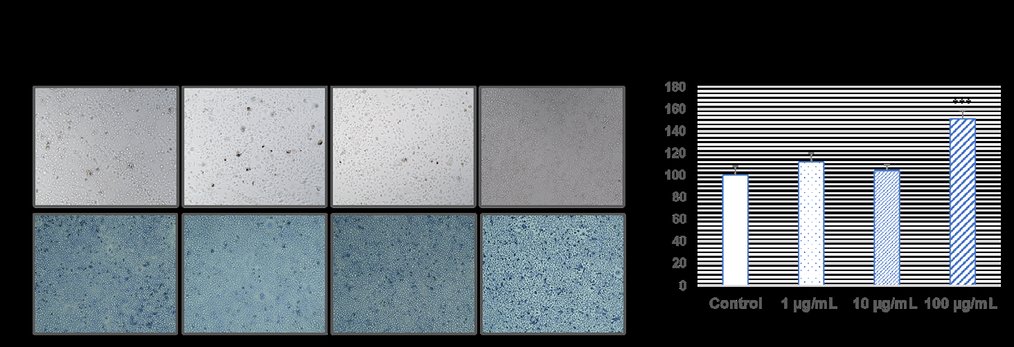 Figure 1: L929 cells with U87 TRAIL resistance exosomes A) Microscope images and B)Cell viability graphics (***p˂0.001 compare to control).