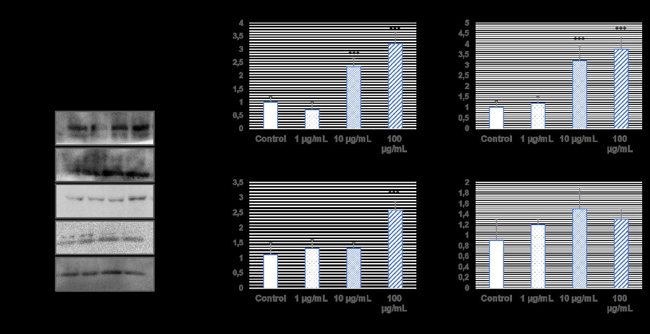Figure 2: Western blotting bands and protein expression changes graphics (***p˂0.001 compare to control).