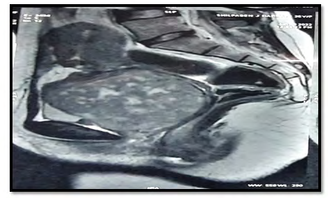 Figure 1: MRI findings.