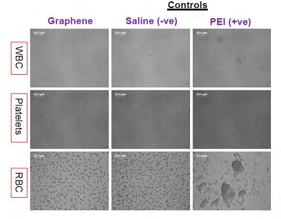 Figure 8: Blood cell aggregation on incubation of graphene with blood from Blood Compatibility and Bio medical Applications of Graphene [13].