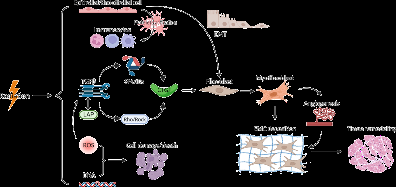 Figure 2: ** Pathogenic mechanism of radiation-induced fibrosis.
