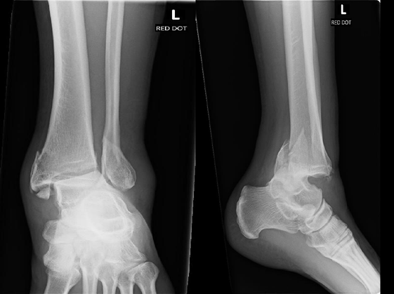 Figure 5