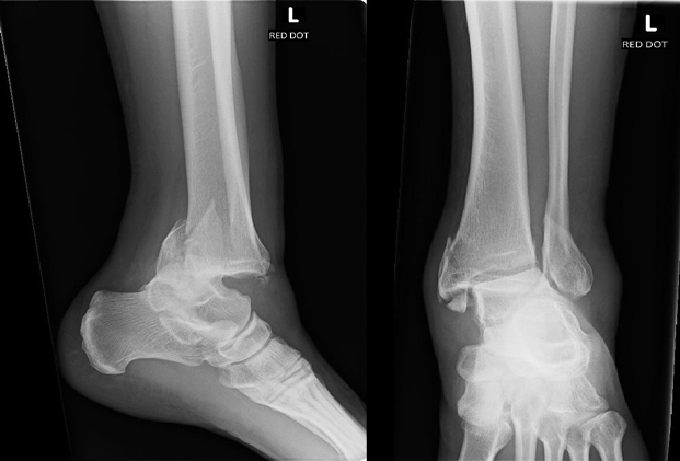 Figure 6