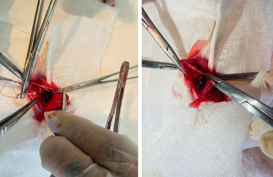 Figure 1: Implantation of spleen fragments into subcutaneous fat.