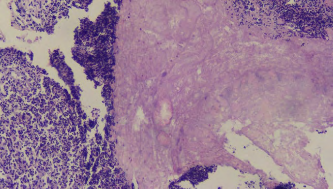 Figure 6: The follicles of the white pulp are mostly uniform in size, with well-defined marginal zones. Stained with hematoxylin and eosin. Ok.10. Ob.10.
