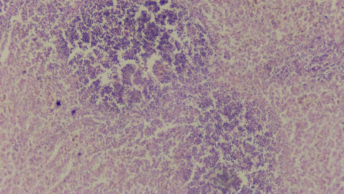Figure 8: Rare foci of necrosis in the pulp of the spleen. Stained with hematoxylin and eosin. Ok.10. Ob.10.