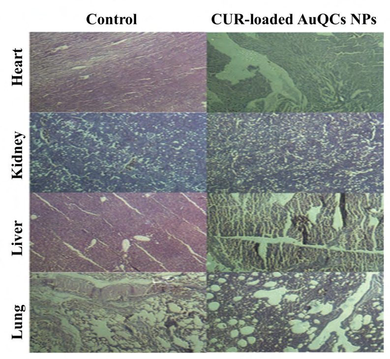 Figure 3: Mice model internal organs after treated with CUR-loaded AuQCs NPs. The results confirmed no significant toxicity was observed in the treated heart, liver, lung, and kideny [7]. Under a Creative Commons Attribution (CC-BY) License.