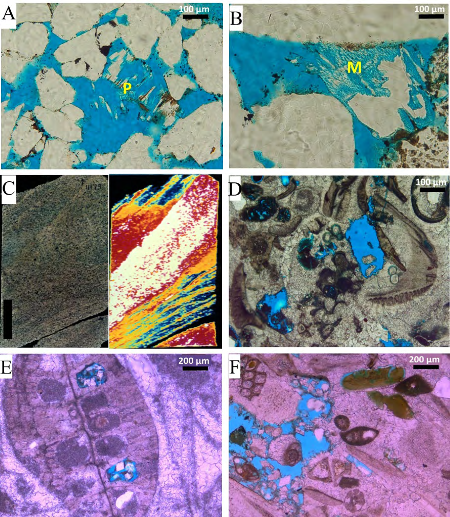 Figure 12: (A) Coarse-grained sandstone with enlarged porosity due to mineral degradation. Plagioclase (P) has been dissolved to form secondary porosity (PPL). (B) Dissolved labile microcline grain (M) and formation of secondary porosity (PPL). (C) X-radiograph image presents the high dense dolomite penetration in the sandstone. (D) Skeletal grainstone with botryoidal grains intraclasts. Intercrystalline porosity enhances the reservoir quality (PPL). (E) Reworked large foraminifera with quartz grains in the internal structure. Spar calcite act as late diagenetic cement with dolomite crystals filling the open cavities (PPL). (F) Grainstone with idiotypic crystal rhombs manifest the late-stage of dolomitization. Intraclasts of Bryozoa grains on the upper left hand. Glauconitized green algae (green pellets) (PPL).