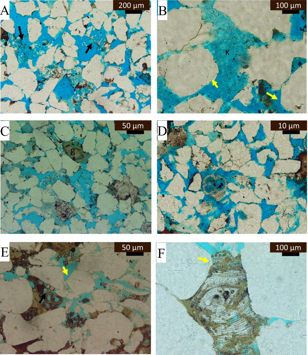 Figure 7: Sandstone lithofacies (A). (A) Arkosic quartz arenite with 25% porosity (blue dye epoxy), note the feldspars dissolution to form secondary porosity. Kaolinite clay infiltration can be observed within the pores. Fine clay film around the quartz grains (PPL). (B) Magnified micrographs present the kaolinite fabric (K) within the pore spaces which may act as a contributor to the microporosity. Faint silica overgrowth (yellow arrow) reduces the porosity (PPL). (C) Coarse grain well-sorted, porous quartz arenite with glauconitized fossiliferous pellets, spar calcite cementation (PPL)(D) Quartz arenite with primary intergranular porosity and secondary moldic porosity, metamorphic rock fragments in the upper left side. Clay cement partially filled the pores on the upper part. (E) Coarse-grained quartz arenite with reworked planktonic foraminifera and dolomite cementation (black arrow) (PPL). (F) Eocene large benthonic foraminifera reworked within the siliciclastic lithofacies (A) accommodation space. Also, silica overgrowth has been recognized (yellow arrow) (PPL).