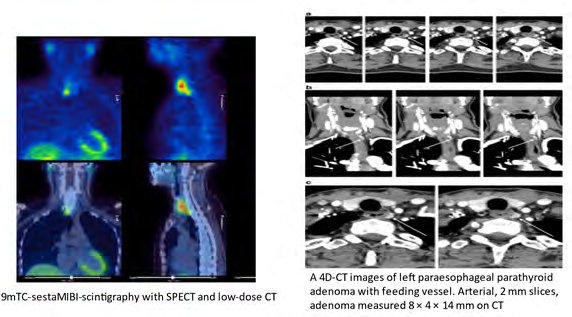 Figure 5: 4D-CT images.