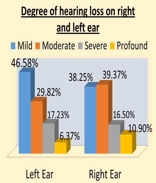 Figure 6: Degree of hearing loss in bilateral ear.