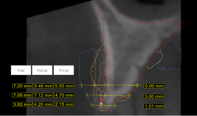 Figure 11