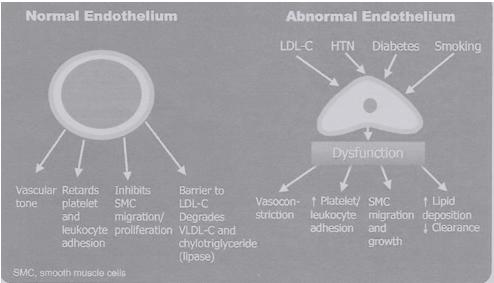 Figure 2: Endothelial Dysfunction [8].