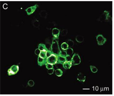 Figure 2: Novel nanoshell encapsulated with an antiangiogenic factor (combrestatin or doxorubicin).