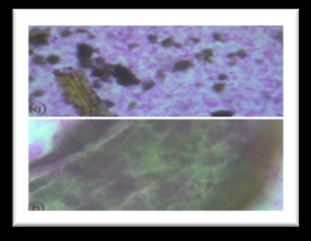 Figure 1: Kutaj (a) Cork cells (b) Fragments Fibres.