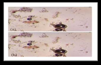 Figure 5: (a) Kutaki (b) cork cells & pith cells.